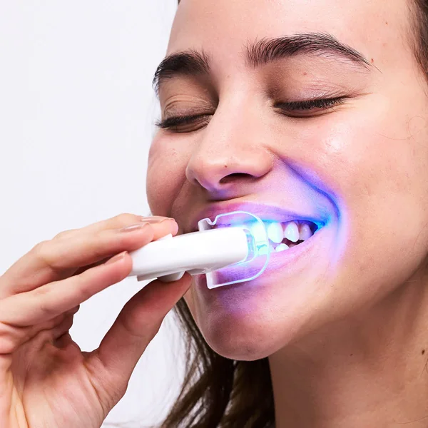 Home Teeth Whitening in St Albans at Happy Family Dental, St Albans